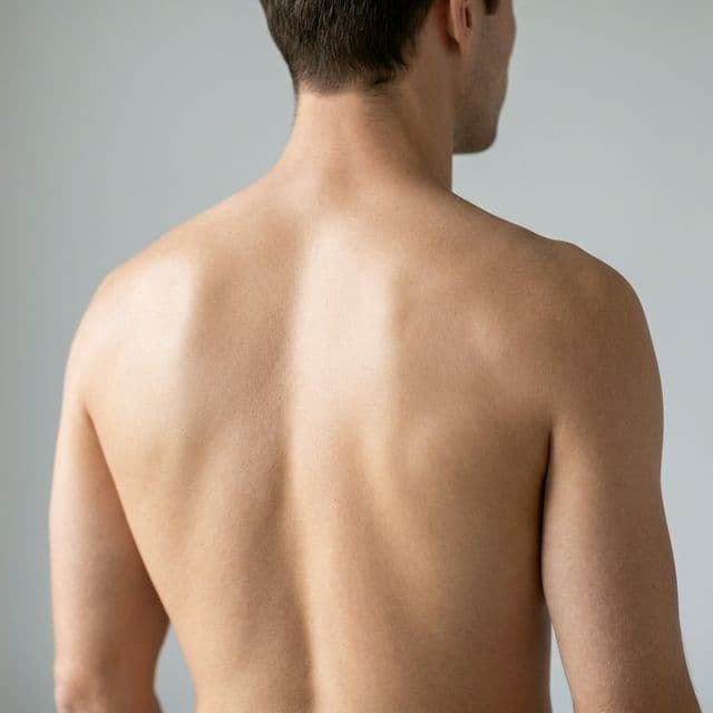 Why Is Back Acne Bothering You? Unpacking What Causes Back Acne in Males