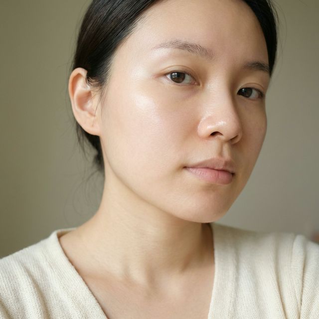 Decoding Acne-Prone Skin: What Is Acne Prone Skin and How to Treat It